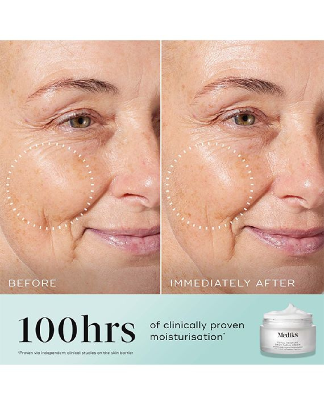 Before and after comparison of a woman's face with visible wrinkles, followed by a Medik8 cream container.