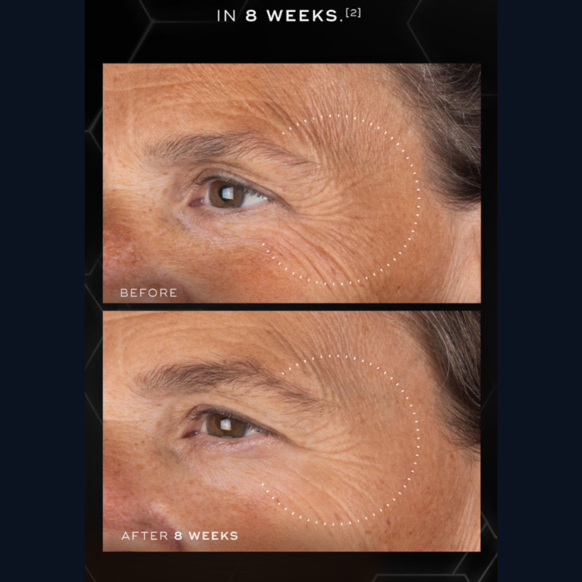 Before and after comparison of facial skin texture with text 'IN 8 WEEKS' above.